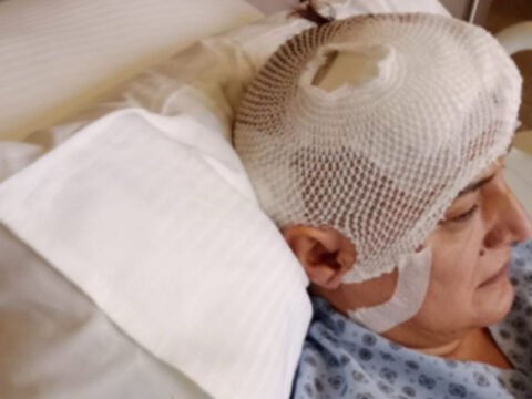 Dis tedavisi kabusa dondu implant sonrasi beyin ameliyati gecirdi q9hMsSVd